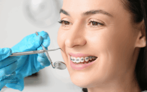 Braces