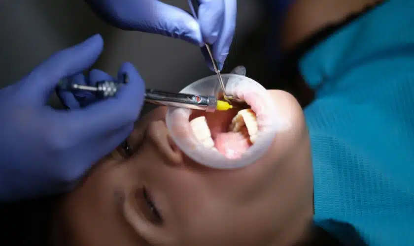 Gum Surgery in Kharadi