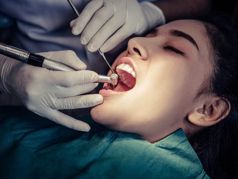 Root Canal Treatment