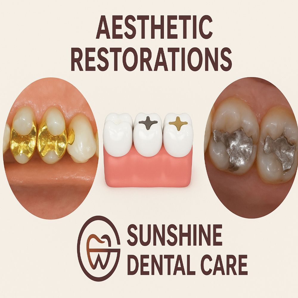 Aesthetics Restorations