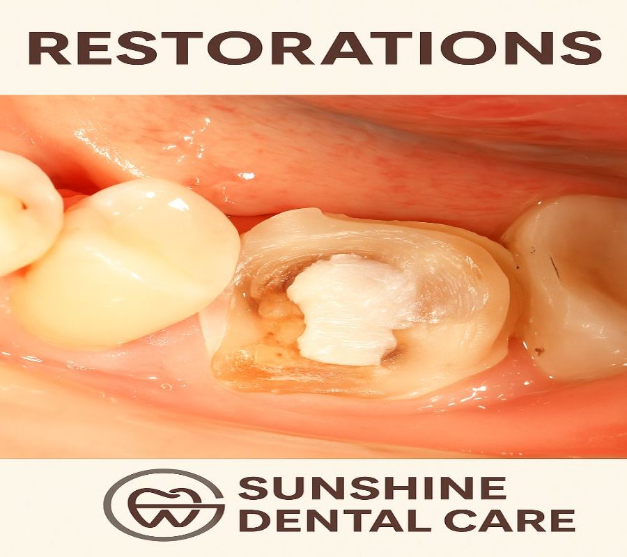 Restorations in Pune