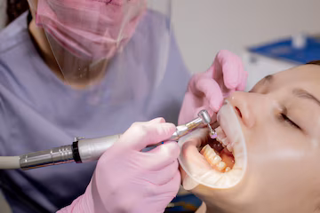 Teeth Cleaning In Pune