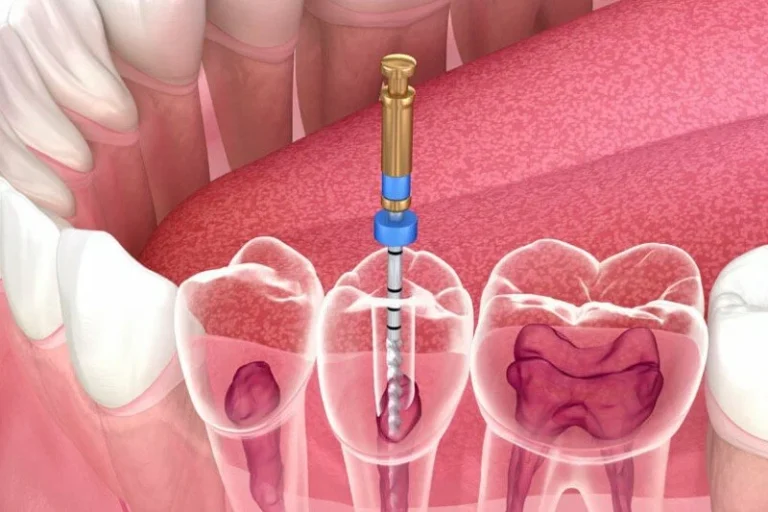 dentist in Magarpatta