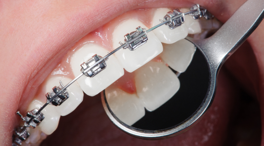 Orthodontics